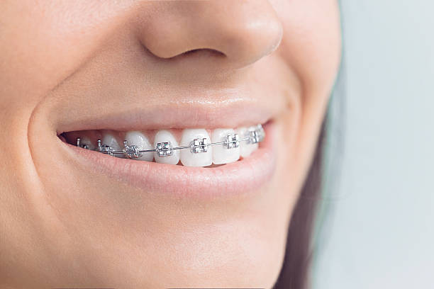 Best Teeth Whitening  in Warren, IL